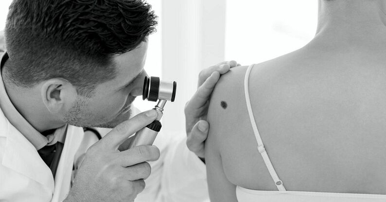 Un especialista diagnostica el tipo de verruga.