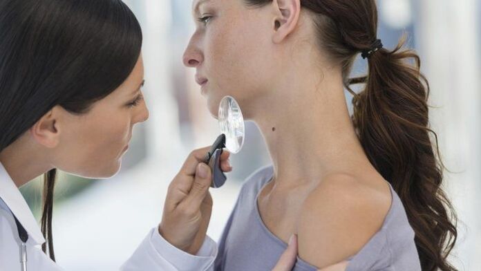 El médico determina el tipo de papiloma en el cuello.